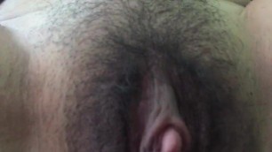 Anal mexicana