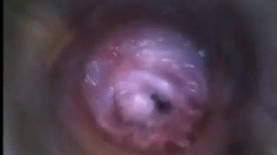 Vagina von innen