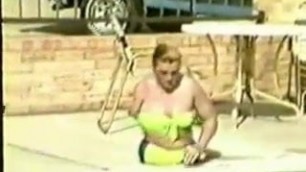 Wonderful triple amputee girl