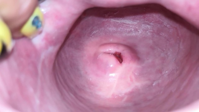Cervix Close up [4k]
